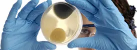Wearing blue gloves and protective eyewear, a person holds up a petri dish with various colonies inside, closely inspecting the sample for further investigation.