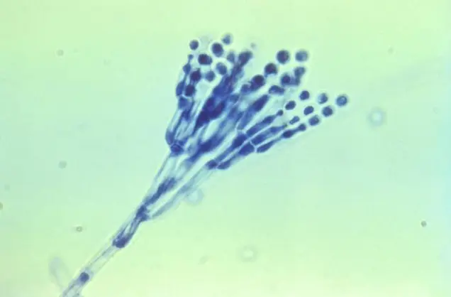 Microscopic inspection reveals blue-stained fungal spores and conidiophores under high magnification. The spores, spherical and clustered at the ends of elongated, branched structures, are set against a light green background.
