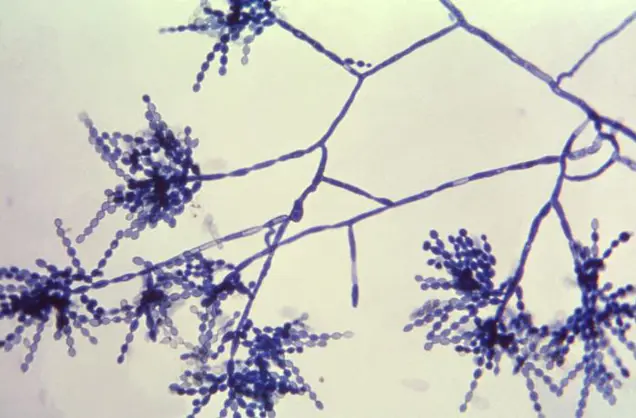 Microscopic inspection of Penicillium mold reveals branching structures with spore chains, stained blue against a light background.
