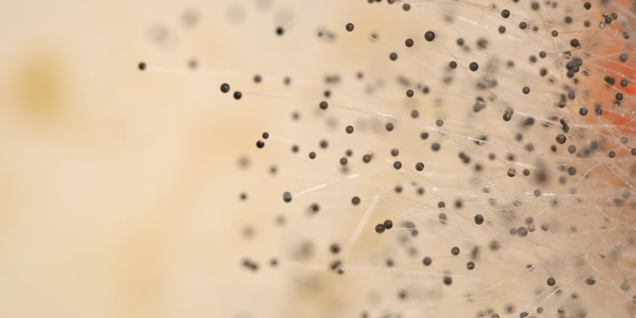 Close-up of mold inspection revealing a network of thin filaments with round black spores at the tips, set against a blurred beige background.